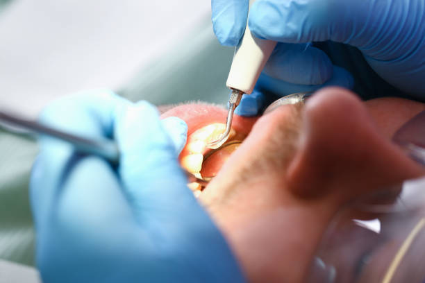 Best Urgent Dental Care for Toothache in Buchanan, VA