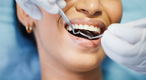Best Mobile Emergency Dentist in Buchanan, VA